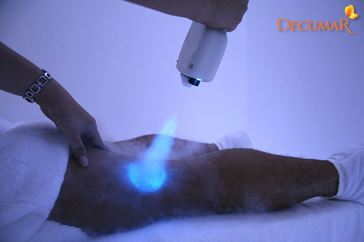 Liệu pháp Cryotherapy là phương pháp trị sẹo thâm và lồi an toàn, tác dụng nhanh chóng
