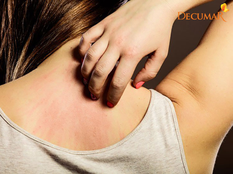 Gãi lưng quá mạnh có thể khiến cho da bị tổn thương và gây viêm