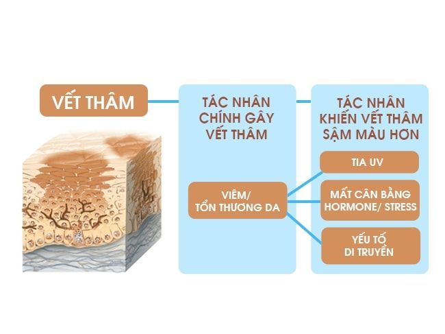 decumar trị thâm mụn