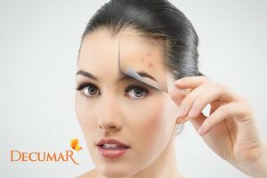 Trị mụn tuổi teen như thế nào nhanh nhất cho nam