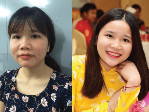 Nam Định: Nữ sinh xấu xí lột xác chỉ sau 2 tháng hè