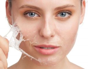 Da mặt nhờn: Nguyên nhân và cách khắc phục