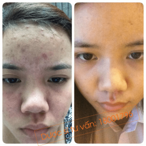Bí quyết cho mình thêm xinh, đời thêm đẹp của cô nàng chăm làm thiện nguyện