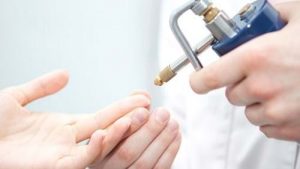 Nguyên nhân khiến bạn bị mụn cóc và cách điều trị