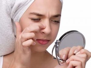Những điều bạn cần biết về cách điều trị mụn an toàn