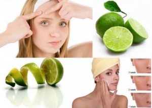 Trị vết thâm mụn hiệu quả từ thiên nhiên với 6 phương pháp