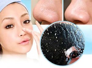 Các cách trị mụn hiệu quả trên thị trường hiện nay