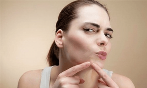 Trị mụn dưới cằm như thế nào mới đúng cách?