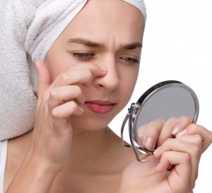 Những điều nên và không nên làm khi trị mụn đầu đen