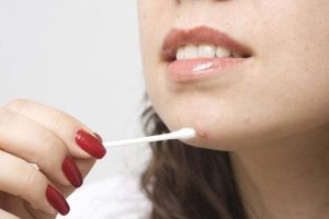 Tuyệt chiêu đánh bay mụn trứng cá ngay tại nhà từ nguyên liệu thiên nhiên