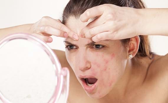 Cách trị mụn thâm cấp tốc siêu an toàn và hiệu quả