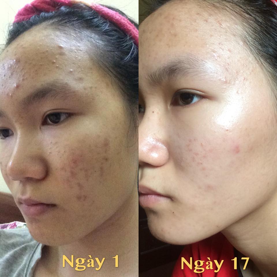 Mai Hương: "Thay vì gọi mình bằng tên Mai Hương, mọi người “chốt” cho mình cái tên “Hương Mụn”