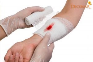 Bị trầy xước da nên làm gì?