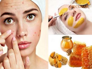 15 công dụng tuyệt vời của nghệ vàng và mật ong