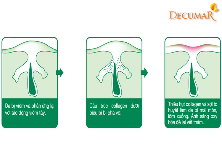 Nguyên nhân gây ra thâm mụn lâu năm