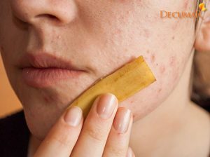 7 mẹo trị mụn bọc nhanh chóng tại nhà mà ai cũng nên biết