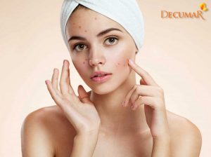 Phục hồi làn da với 6 bước trị thâm sẹo sau mụn hiệu quả
