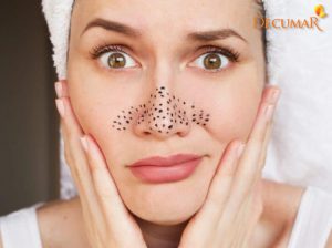 Mụn đầu đen là gì ? Nguyên nhân, dấu hiệu và cách điều trị hiệu quả