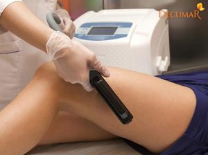 Trị sẹo thâm lâu năm ở chân – Dùng laser hay công thức tự nhiên?