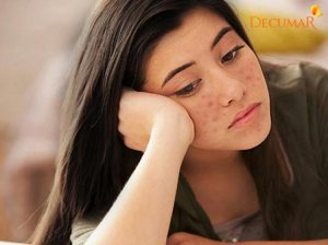 Cách trị mụn và thâm tại nhà với 9+ thần dược từ thiên nhiên