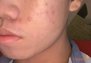 Dù là con trai, cũng đừng nên chọn sai sữa rửa mặt