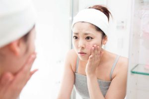 Da mặt bị trầy xước thì cần phải làm sao?