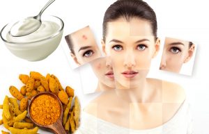 Tiết lộ 10+ loại mặt nạ trị mụn bọc hiệu quả và an toàn