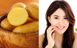 [ Mẹo ] 5 cách dùng khoai tây trị mụn đầu đen cực kỳ hiệu quả