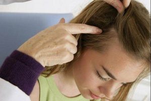 Mụn trứng cá trên da đầu : Nguyên nhân, dấu hiệu và cách điều trị