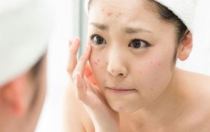 Skincare routine nhanh gọn nhẹ cho học sinh